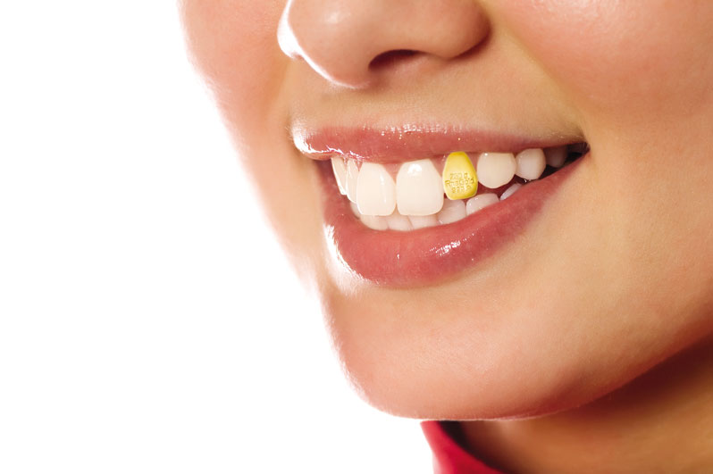 Woman's mouth depicting dental gold 